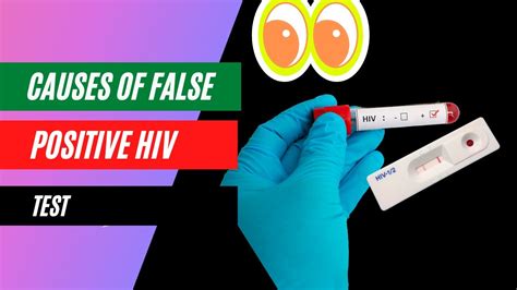 Understanding Possible False Positive HIV Test Results: Key Information and FAQs