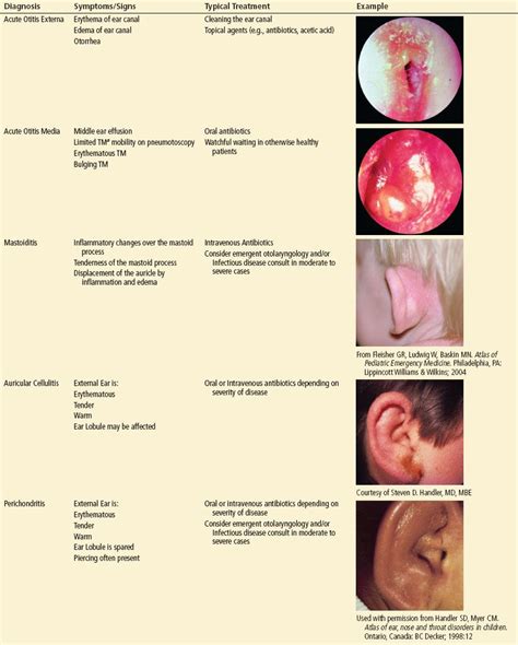 Understanding Ear Infections in Adults and Effective Surgical Treatments