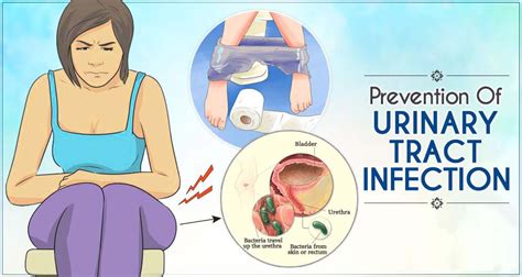 Understanding Urinary Tract Infections: Symptoms, Causes, and Treatments