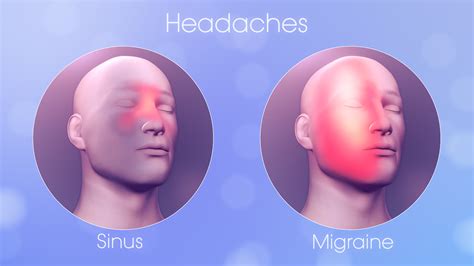 Understanding Headaches: When to Worry and How to Treat Migraines and Sinus Issues