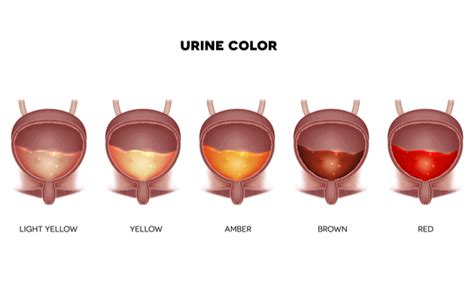Understanding Itchy Skin and Urinary Tract Infections: Causes and Treatments