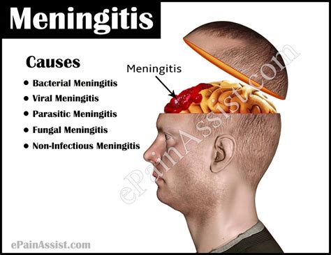 Understanding Meningitis in Children: Causes, Prevention, and Treatment